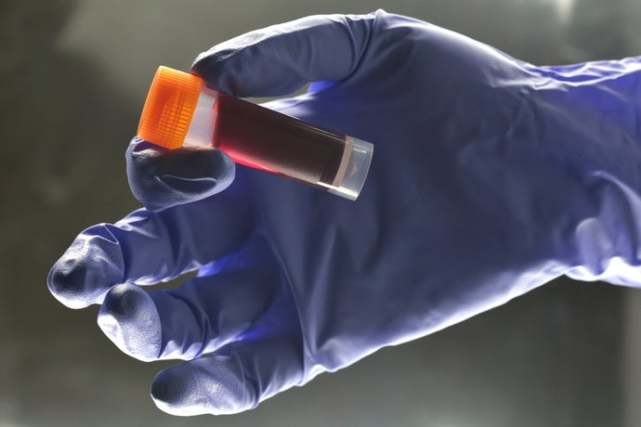 Scientists have discovered a new strain of HIV for the first time in nearly 20 years!